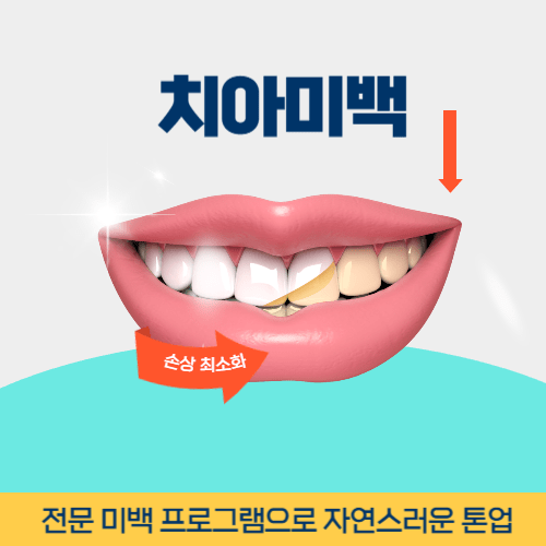 울산치과 울산광역시 치과 치아미백