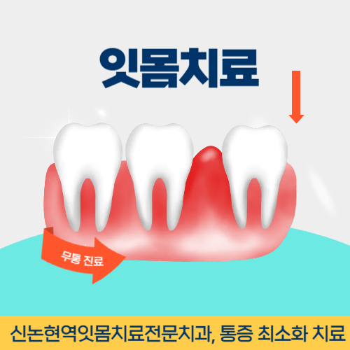 울산치과 울산광역시 치과 잇몸치료